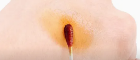 碘伏为何如此广谱？——从作用机理看不同抗菌剂的抗菌谱差异
